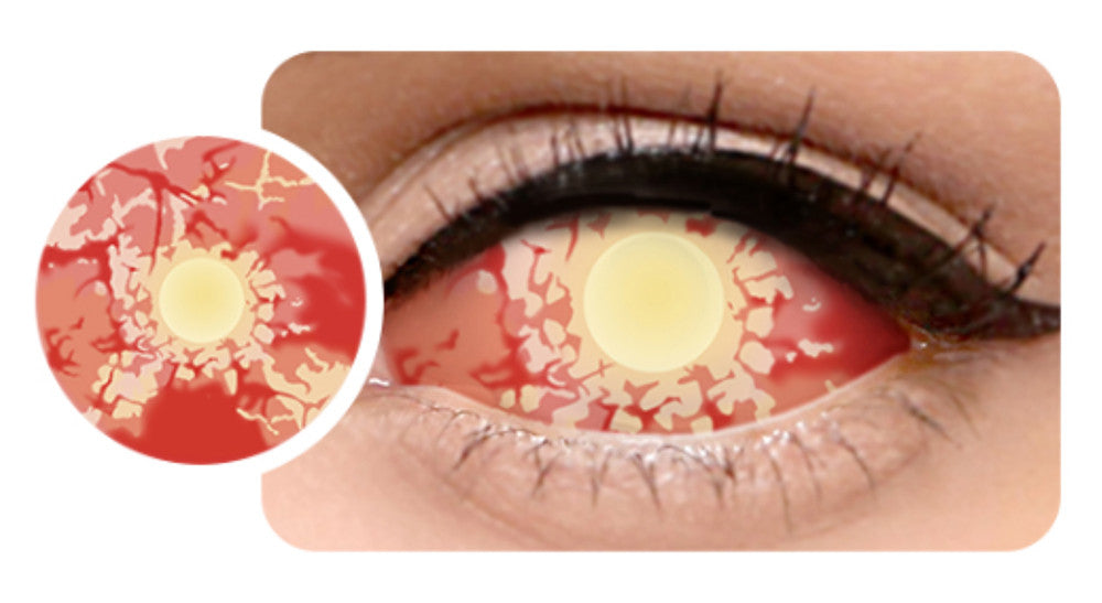 zombie sclera contact lenses cover the whole eye for the ultimate theatrical effect