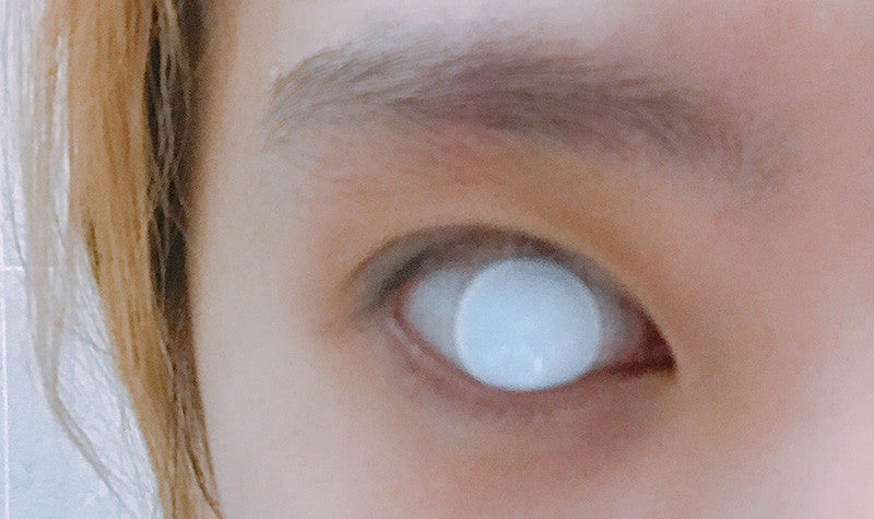 White Blind Circle Lenses