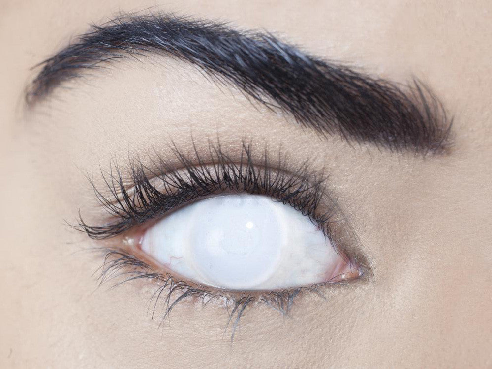 17mm White Blind Circle Lenses | Yearly