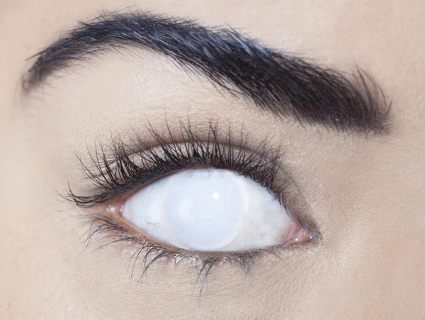 17mm White Blind Circle Lenses | Yearly